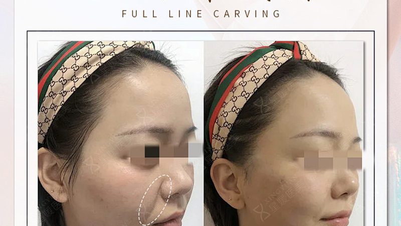 岁轻医美项目推荐