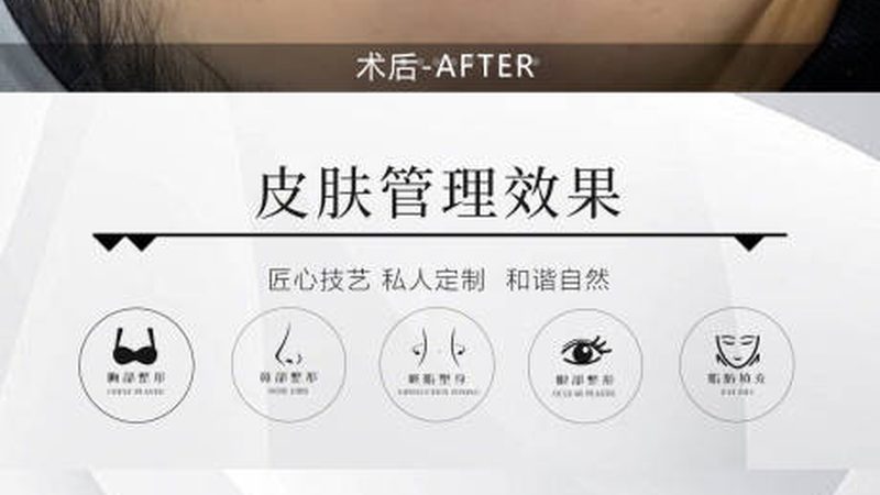 小标题：双眼皮手术，了解其本质