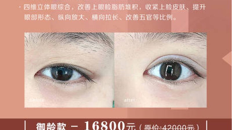轻医美术前准备与术后禁忌，避免术后遗憾