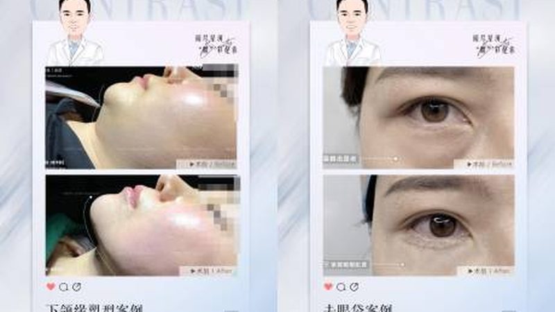 注射美容：哪些年龄群体需谨慎选择？**