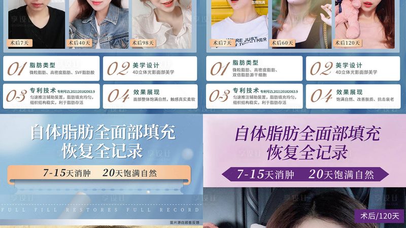 厦门双眼皮修复宽改窄，揭秘费用构成与选择要点