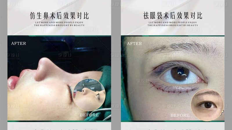 注射美容前，以下几种药物需要停用：