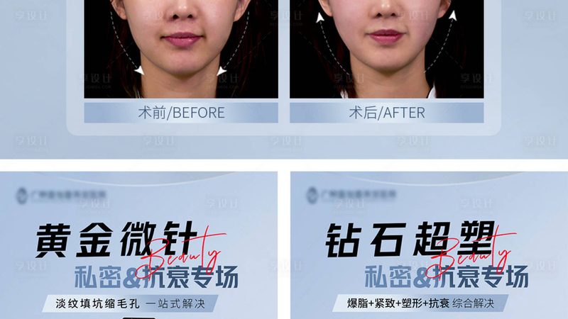 超声炮代理怎么选