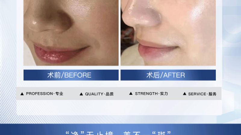 广州皮肤美容诊所收费标准揭秘：看懂这些，才能明智消费