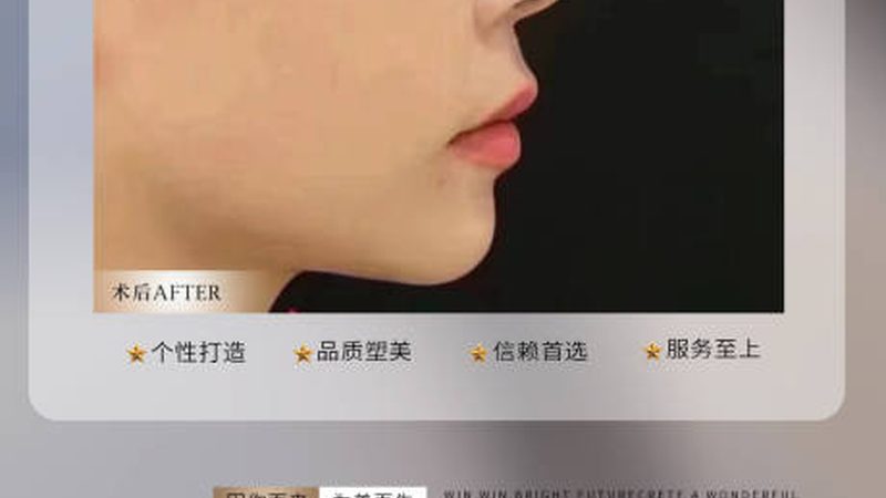注射美容，这些禁忌症你了解吗？**