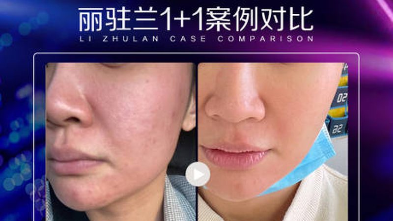 皮肤管理店选址：避开这些“雷区”才能稳扎稳打