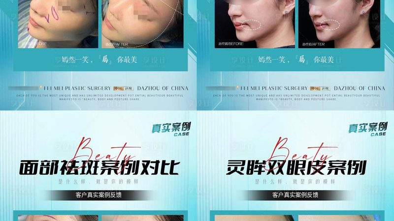 轻医美与微整形，揭秘操作流程背后的秘密