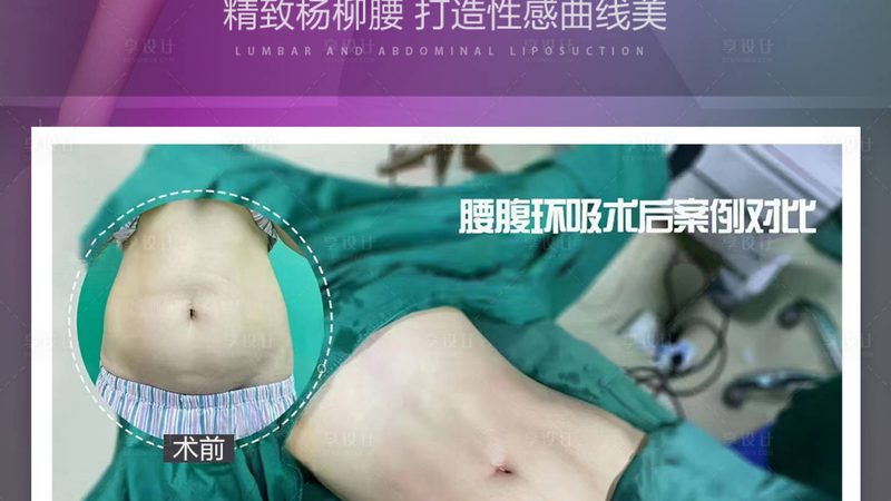 热玛吉治疗头参数误差，揭秘影响效果的关键因素