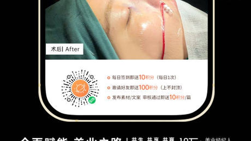 热玛吉2025：揭秘价格背后的技术秘密