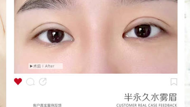 热玛吉与超声炮：揭秘两者差异与参数对比