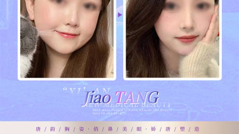 美容院超声刀：便捷但专业度有限