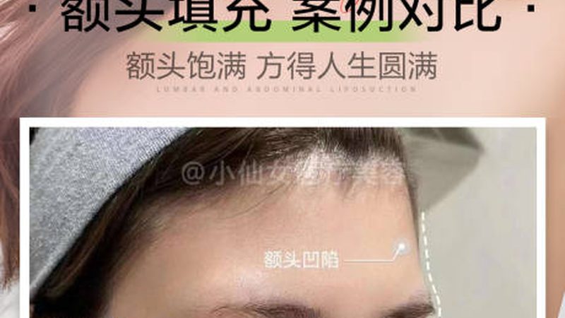 皮肤管理仪的参数真实性直接关系到其效果和安全性。消费者在选购时，应关注以下参数：